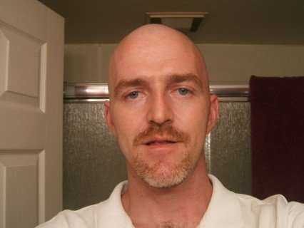 Shaved Head - After - Front View