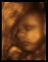 3D Ultrasound of Ace at 29 weeks!