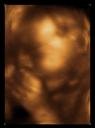 3D Ultrasound of Ace at 29 weeks!